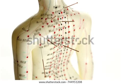 Female Acupuncture Model Needles Shoulder Stock Photo 744951208