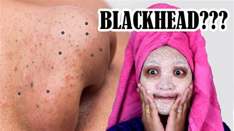 Product Review Cara Hilangkan Blackhead Whitehead Youtube