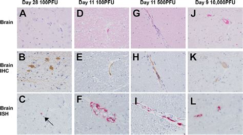 Representative Histologic Lesions In The Brain Of Cynomolgus Macaques