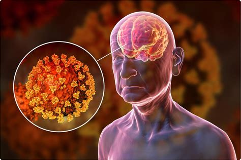 Neurological Complications Of The Sars Cov Vaccine