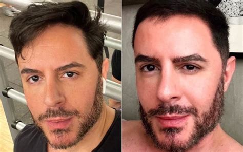 Antes E Depois De Ricardo Tozzi Confunde A Web O Que Aconteceu Aqui