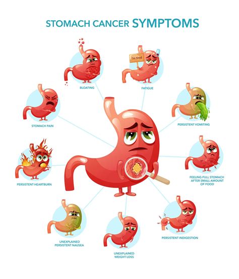 Stomach Gastric Cancer Signs Diagnosis And Treatment In Singapore