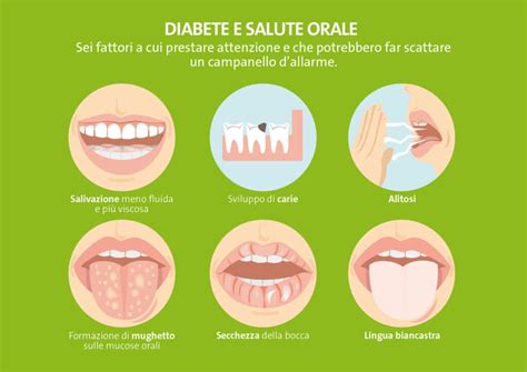 Cose Da Sapere Su Diabete E Salute Orale