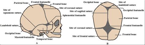 Fetal Skull Sutures