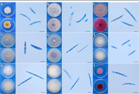 Fusarium Spp An Overview