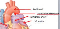 Cardio 1.02 - Heart Anatomy Flashcards | Quizlet