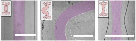 Micromachines Free Full Text Patterning Biological Gels For 3d Cell Culture Inside