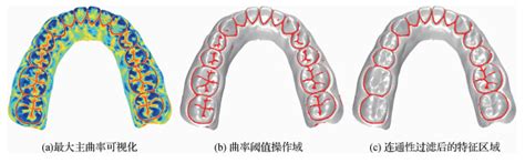 Matlab牙齿分割3维牙颌模型牙齿分割的路径规划方法随风涂梅明的博客 Csdn博客