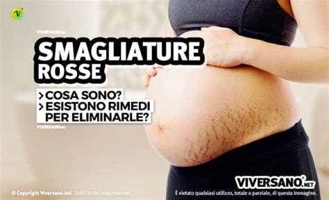 Smagliature Rosse Cosa Sono Come Eliminarle E Prevenirle