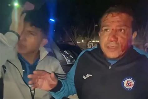 Aficionado de Cruz Azul denuncia ser golpeado por la policía para que