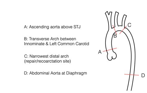 Figure S Location Of Aorta Measurements A Level Of Cmr Flow