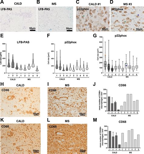 Enlarged foam cells coincide with an increased number of activated and ...