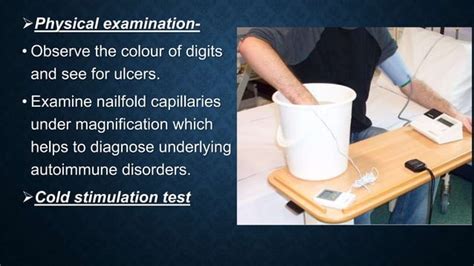 Raynauds Disease And Its Management Ppt