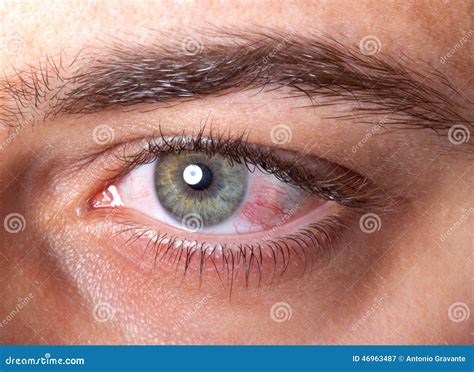 Irritated Red Bloodshot Eye Stock Photo - Image: 46963487