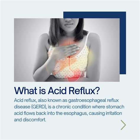 5 Things You Should Know About Acid Reflux Gastroenterologist Los Angeles