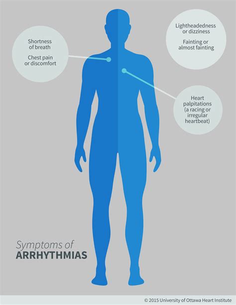 Arrhythmias (Heart Rhythm Disorders) - Ottawa Heart Institute