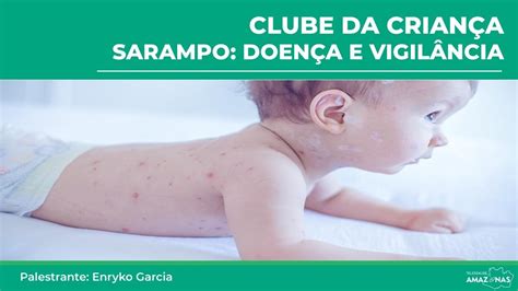 Clube da Criança Sarampo Doença e vigilância YouTube