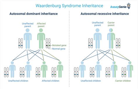 Waardenburg Syndrome and Klein-Waardenburg Syndrome - Assay Genie