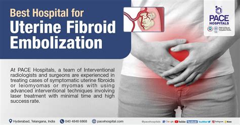 Uterine Artery Embolization For Postpartum Hemorrhage