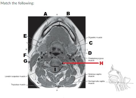 Axail_MRI_valleculae Diagram | Quizlet