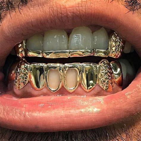 Pin By Marrontrxck On Teeth In Grillz Gold Teeth Grills Grills