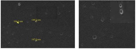 Morphological Characterization Of H Pylori Derived OMVs A Scanning