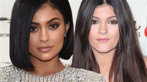 Kylie Jenner Hits Back At Claims Shes Had Cheek And Jaw Surgery As Her