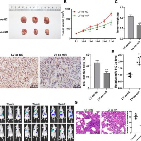 Overexpression Of Mir 140 3p Inhibited The Growth And Metastasis Of Gc