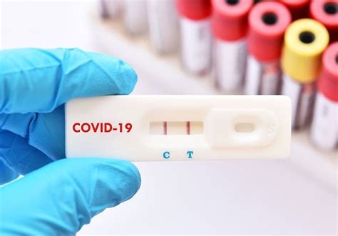 Test PCR sau antigen COVID negativ obligatoriu pentru români la