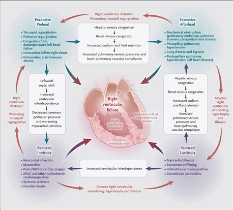 Insuficiencia Ventricular Derecha