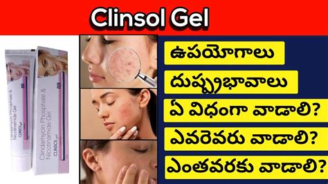 Clinsol Gel In Review Telugu Best Medicine To Clear Acne Pimples