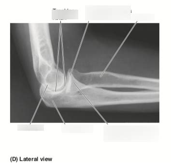 Diagram Of Lateral Elbow Xray Quizlet