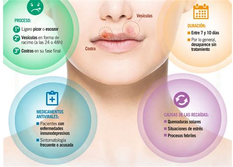 Cuánto dura el herpes labial Diario Salamanca