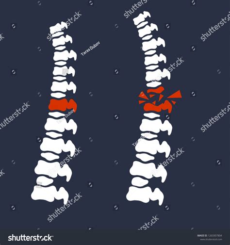 Problems Spine Posture Issues Sick Red Stock Illustration 1263307804
