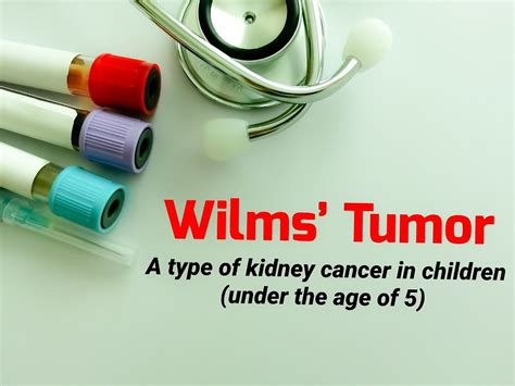 World Kidney Day Know Symptoms Diagnosis Treatment Of Wilms Tumor