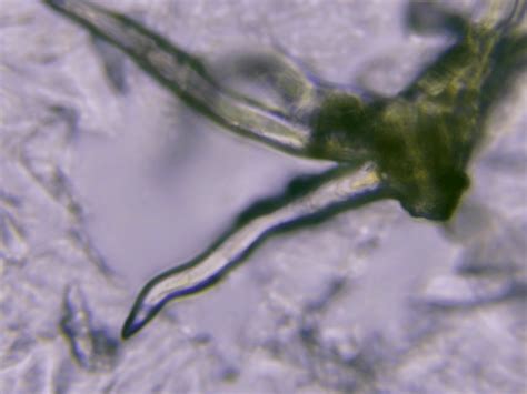 The Lyme star larvae are captivating. Views at 10,000x, 2500x and 1000x