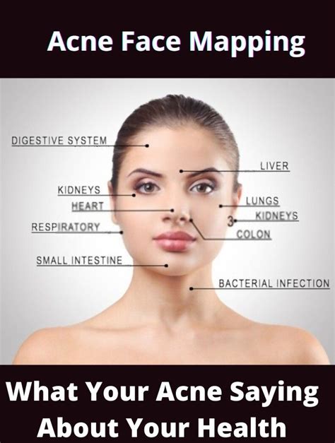 How To Treat Cystic Pimple On Forehead Causes And Prevention Artofit