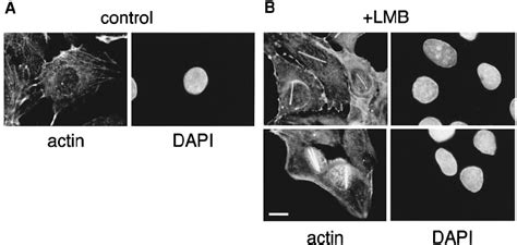 Effect Of Lmb On The Subcellular Distribution Of Endogenous Actin A