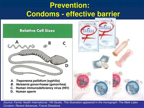 Ppt Opportunities And Challenges In Reducing Heterosexual Hiv Transmission Condoms Anti