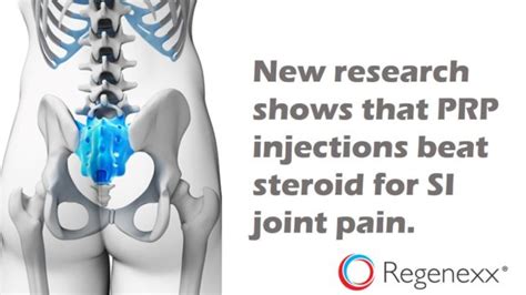 Stem Cell Therapy And Prp For Sacroiliac Joint Pain Regenexx