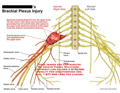 Medical Exhibits Demonstrative Aids Illustrations And Models