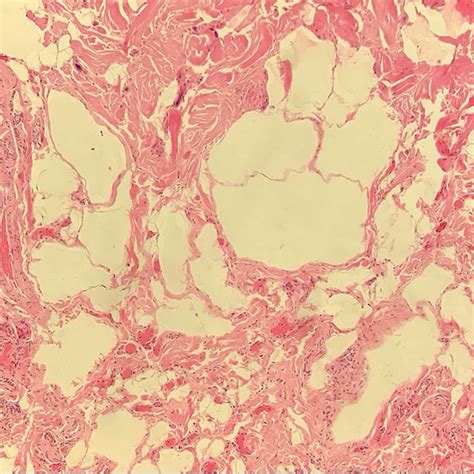 Histology Slide With Hematoxylin And Eosin Staining On Low