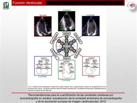 Funcion Ventricular PPT