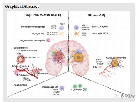【烈冰助力】神经胶质瘤和肺癌脑转移的单细胞肿瘤微环境解析