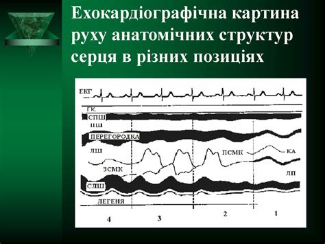 Насосна функція серця. Ехокардіографічна оцінка серцевої діяльності ...
