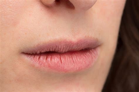 What Causes Constant Dry Mouth And Lips Lipstutorial Org