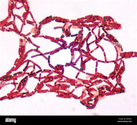 Bacillus Anthracis Fotograf As E Im Genes De Alta Resoluci N Alamy