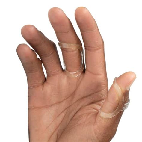 What Can I Do About My Trigger Finger Treatment