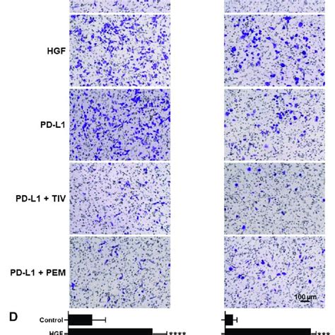 Met Inhibition Can Block Pd L Induced Cell Motility And Migration A