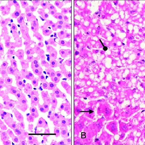 High Magnification Photo Micrographs Of Hematoxylin And Eosin Stained